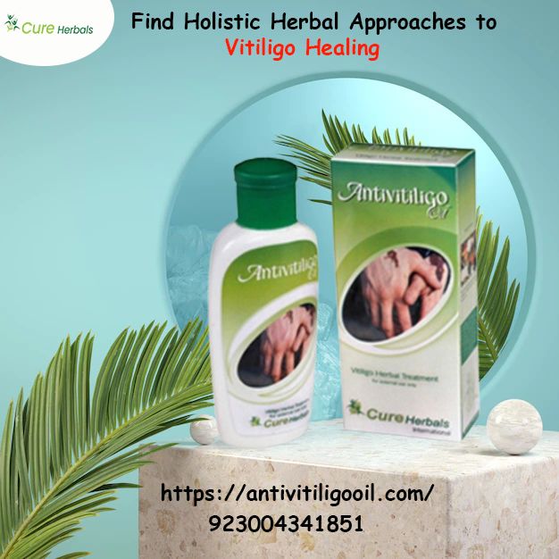 Find Holistic Herbal Approaches to Vitiligo Healing